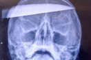 Gamer stabbed through head for cheating