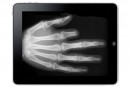 Man loses iPad and finger